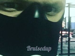 Bruisedup